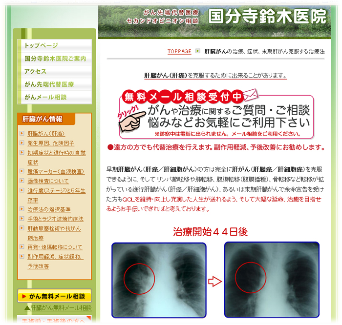 肝臓癌イメージ