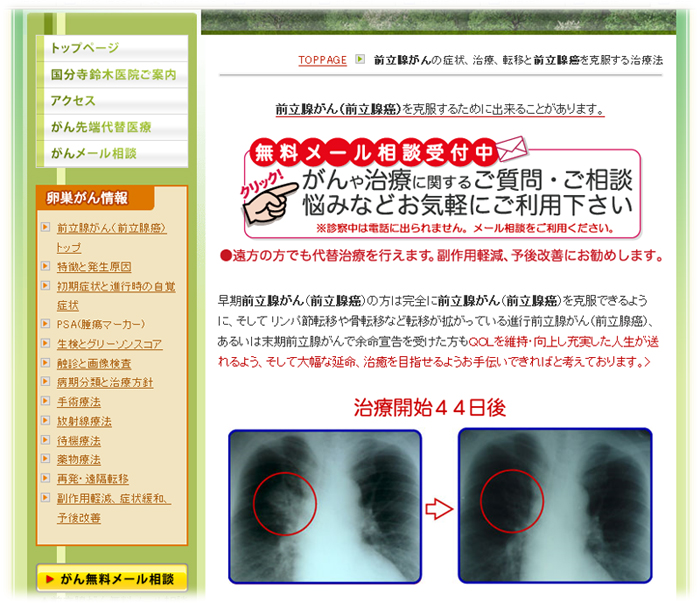 前立腺癌イメージ