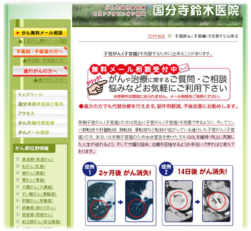 子宮癌イメージ 子宮癌イメージ